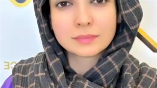 اصلاح فرم ابرو به روش سوپر نچرال