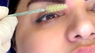 کاشت ابرو به روش میکرو sut