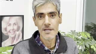 ایمپلنت دیجیتال هر دو فک با روکش موقت در یک جلسه