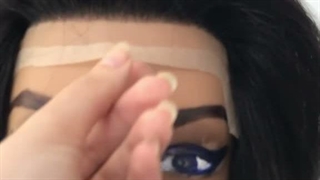 پروتز مو