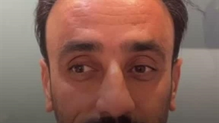 کاشت مو