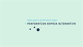 40 Open Gastric Perforation Repair