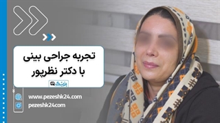 سه هفته بعد از عمل بینی در مشهد؛ تجربه یک زیباجو از روند بهبودی - پزشک 24