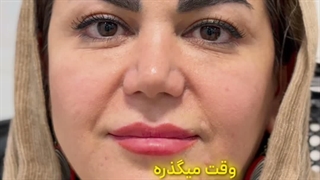 رضایت زیباجوی عزیز از کاشت ابروی طبیعی