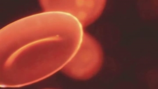 Multiple Myeloma and Lenalidomide: Symptoms, Treatment & Care