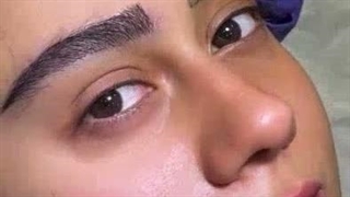 میکرو کاشت ابرو در کلینیک آرارز
