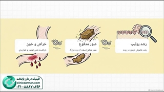 آیا خون در مدفوع نشانه سرطان است؟clinicdarman.com