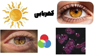 مزیت های ناعادلانه‌ی هر رنگ چشم