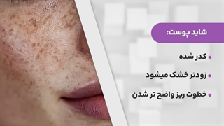 چه روش هایی برای جوانسازی پوست مناسب است؟