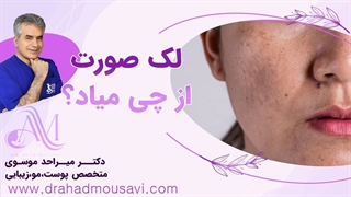 چرا صورت ما لک دار می‌شود؟