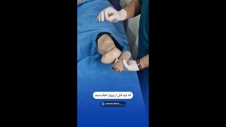بانداژ ایت - راز آماده سازی قبل از پروتز