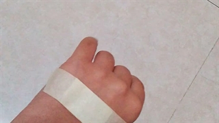 بله دوستان همونطور که می‌بینید با سرم سوراخ سوراخ کردن1(ToT)
