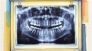 مرکز تخصصی رادیولوژی دندان، فک و صورت دکتر نکیسا ایل برای چه افرادی مناسب است؟