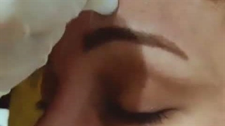 میکرودرم ابریژن سالن زیبایی بورگ پردیس