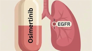 Osimertinib 80 mg Explained | EGFR-Positive Lung Cancer Treatment In Philippines