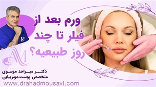 ورم بعد از فیلر؛ آیا باید نگران باشیم یا این بخشی از روند بهبودی است؟